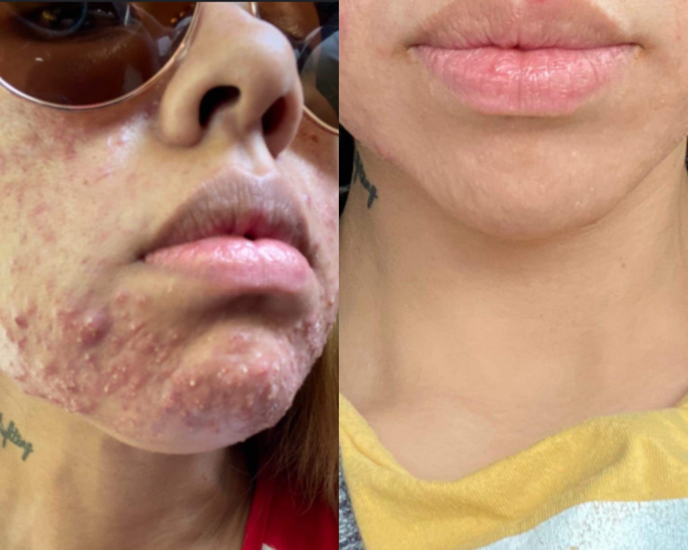 Elenas Before and After