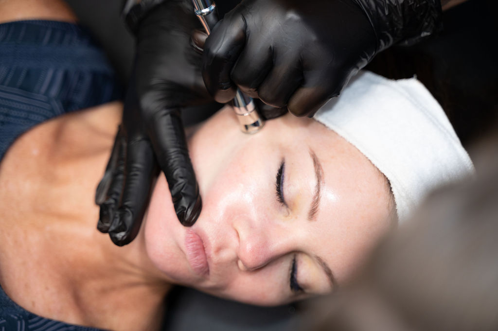 Microderm Treatment at Smoothe & Co.