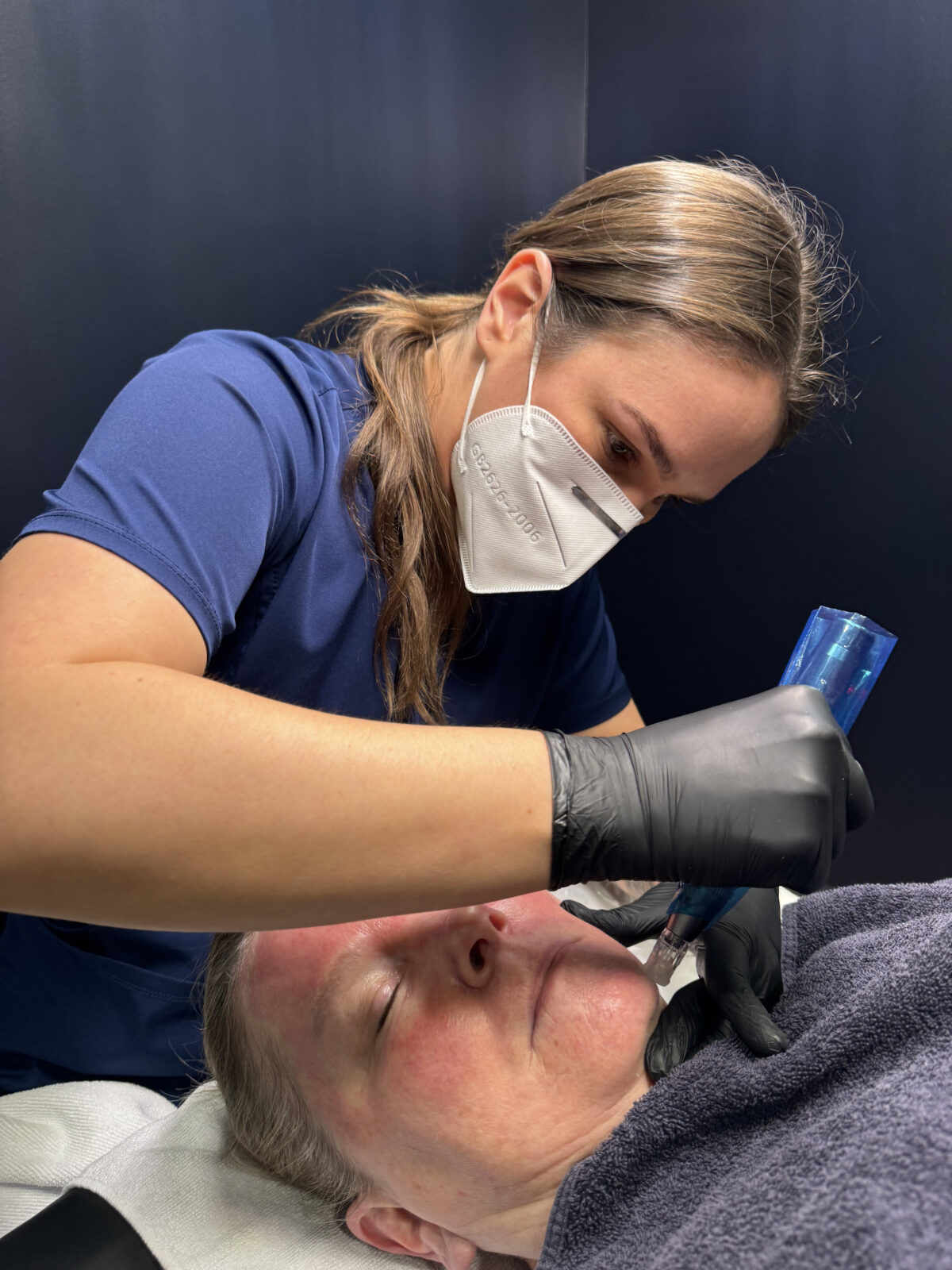 Microneedle at Smoothe & Co. in Raleigh, NC.