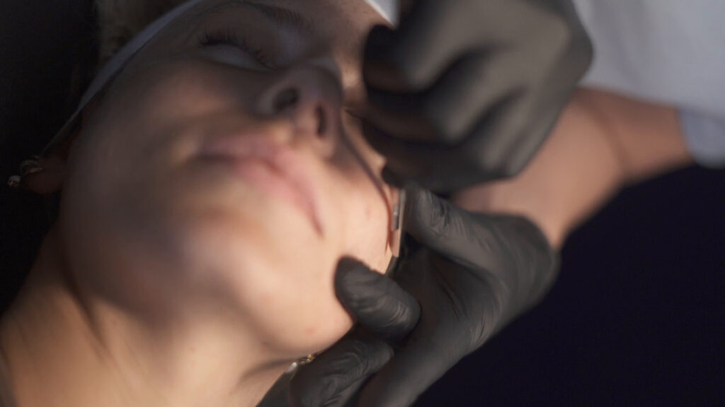 Dermaplaning in Raleigh with Lindsey Westendorf at Smoothe & Co.