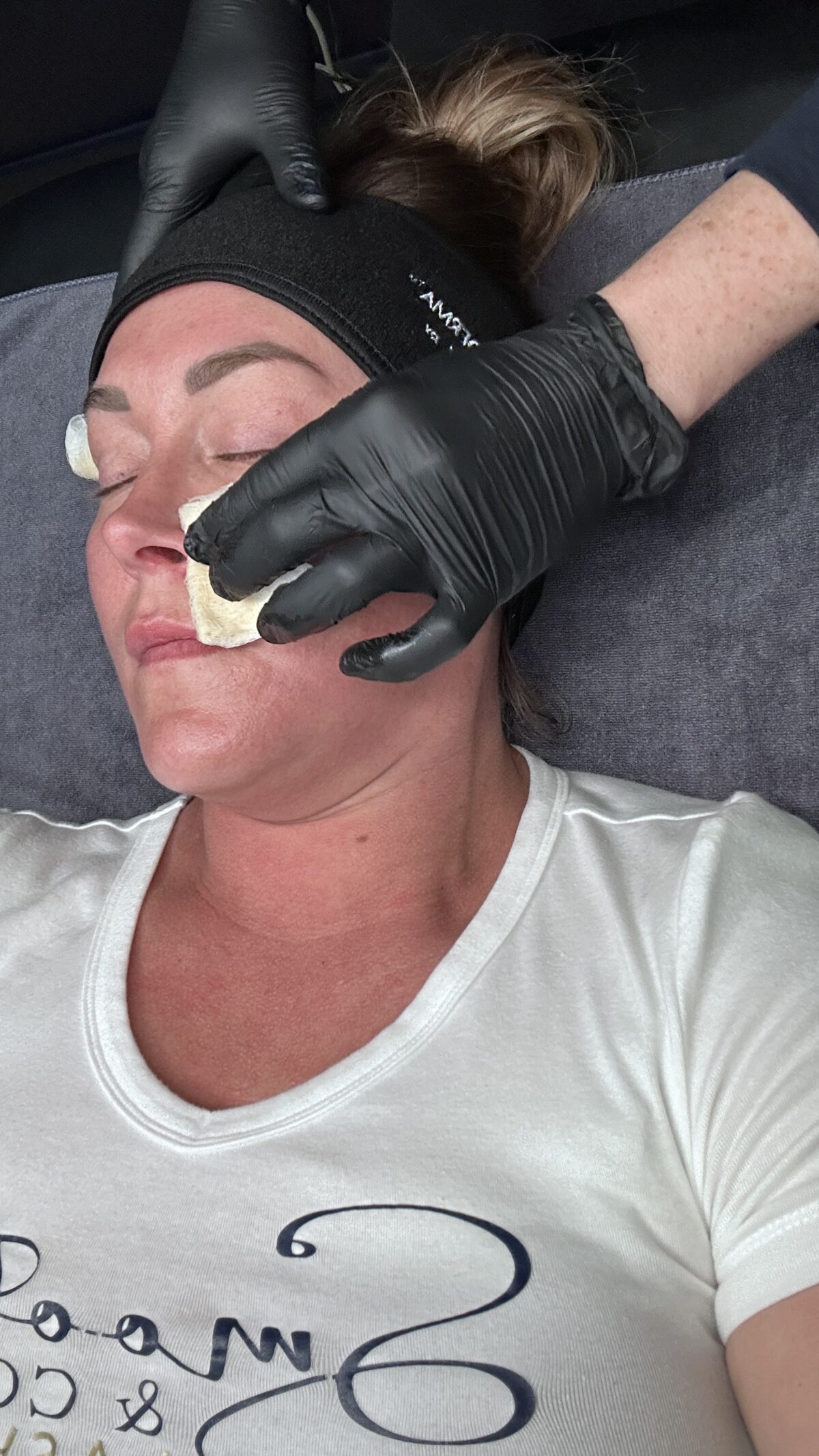 The Perfect Derma Peel at Smoothe & Co. in Raleigh, NC. Chemical peels in Raleigh.