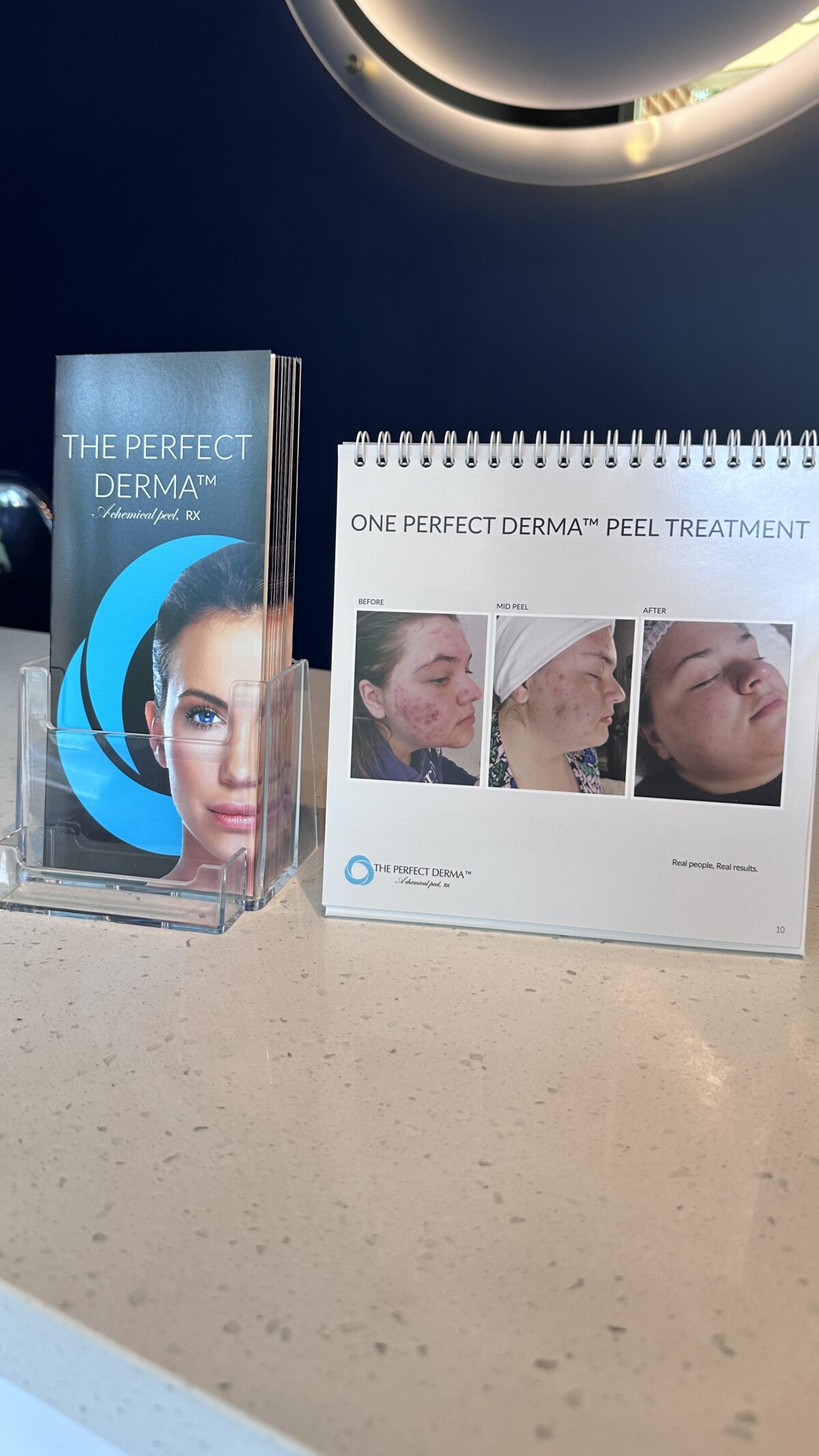 The Perfect Derma Peel in Raleigh, NC. Best peel in Raleigh at Smoothe & Co.