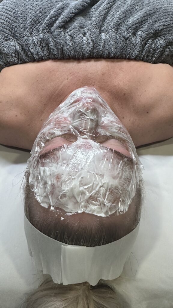 Microneedling near me in Raleigh, NC.